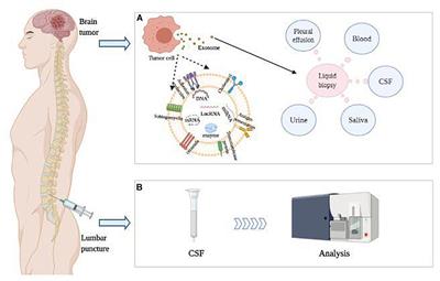 Evolving Landscape of Long Non-coding RNAs in Cerebrospinal Fluid: A Key Role From Diagnosis to Therapy in Brain Tumors